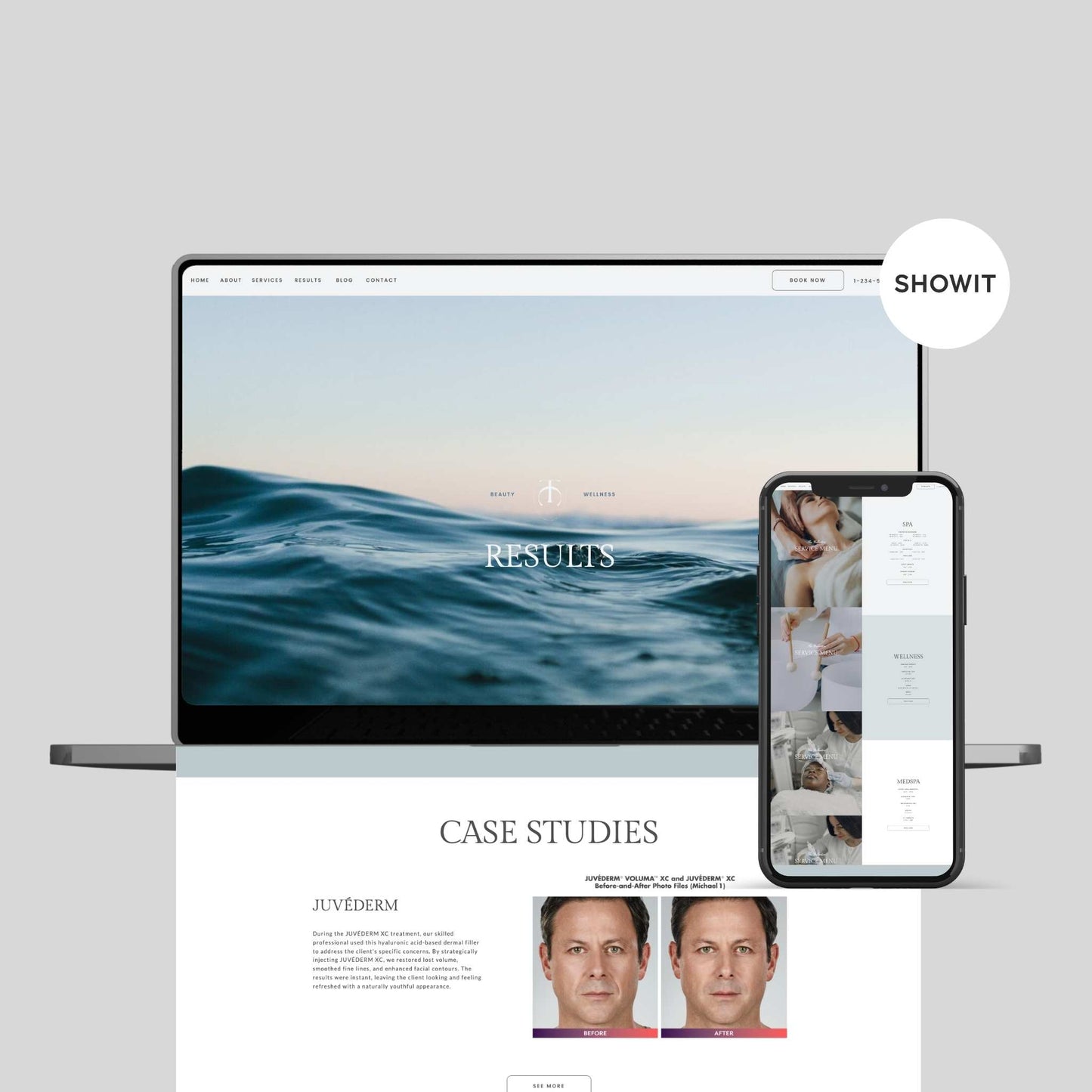 Luxury Website Template For MedSpa